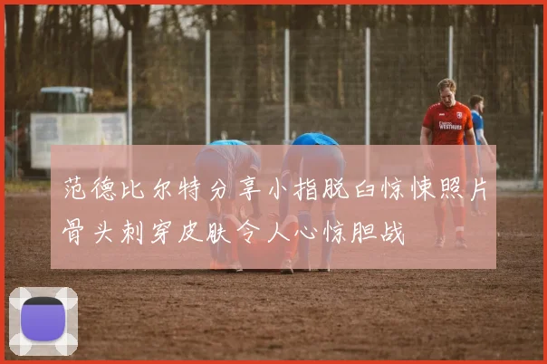 范德比尔特分享小指脱臼惊悚照片骨头刺穿皮肤令人心惊胆战